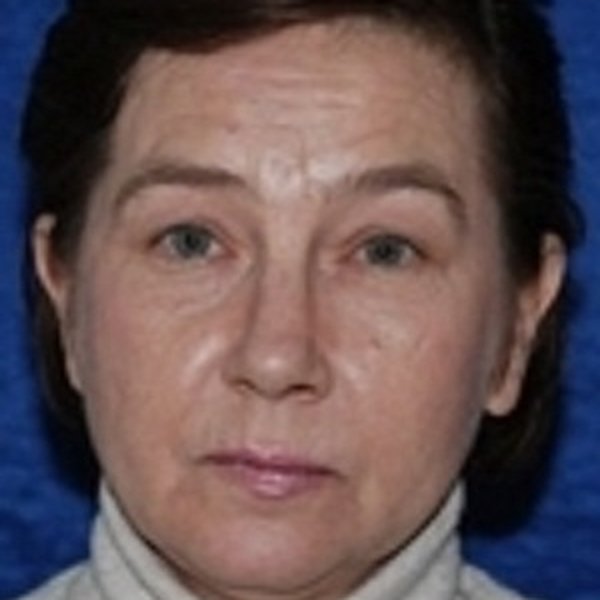 Marina Gapchenko