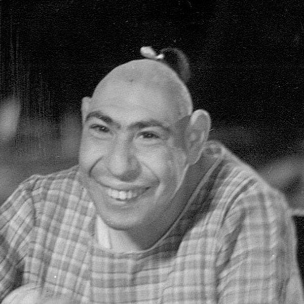 Schlitzie