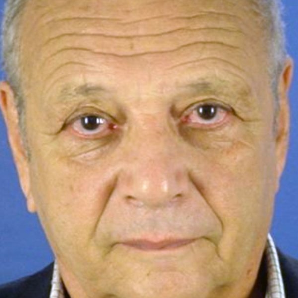 Harry Havilio