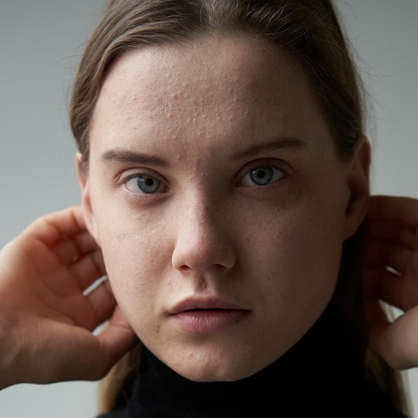 Margarita Mezina
