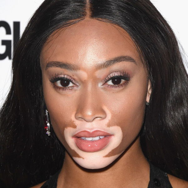 Winnie Harlow