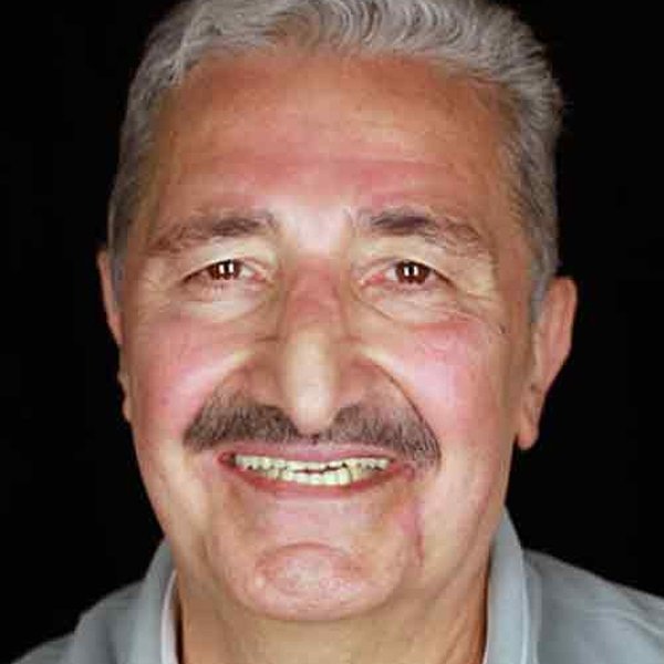 Yaşar Güner