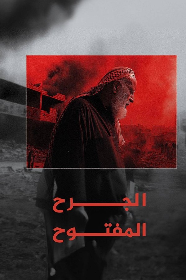 ‏الجرح المفتوح