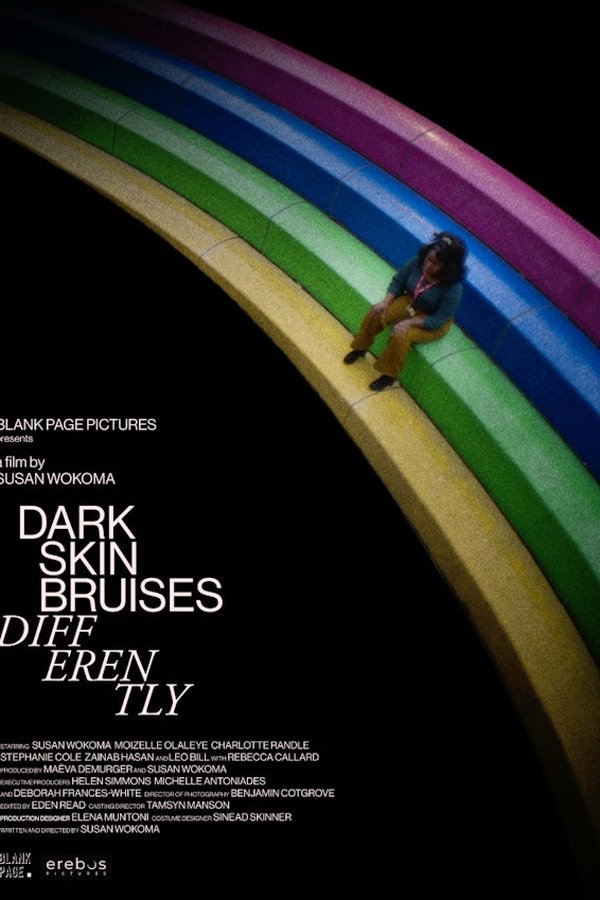 Dark Skin Bruises Differently
