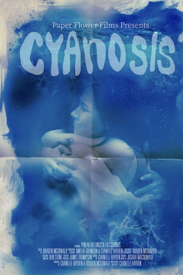 Cyanosis