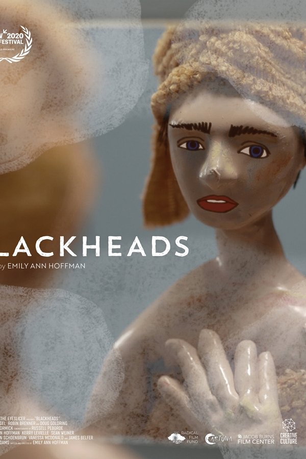 Blackheads