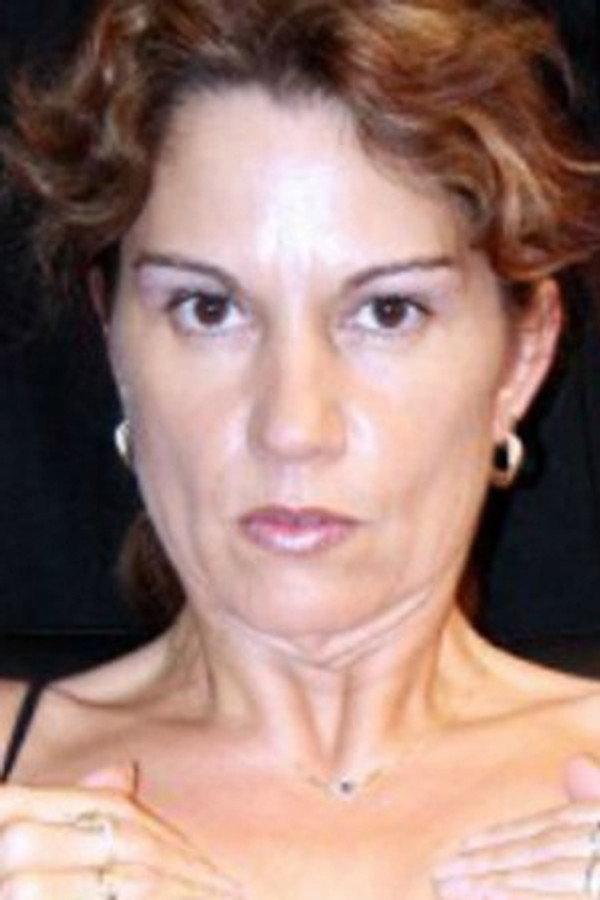 cast