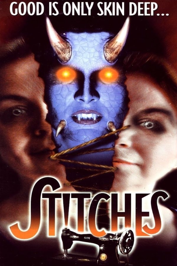 Stitches