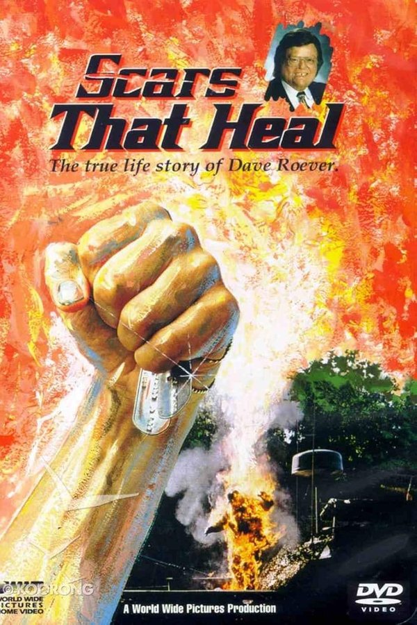 Scars That Heal: The Dave Roever Story