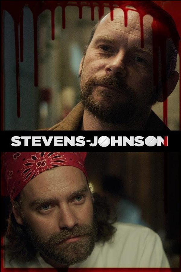 Stevens Johnson