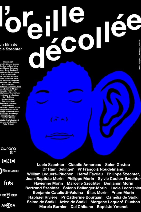 L'oreille Décollée