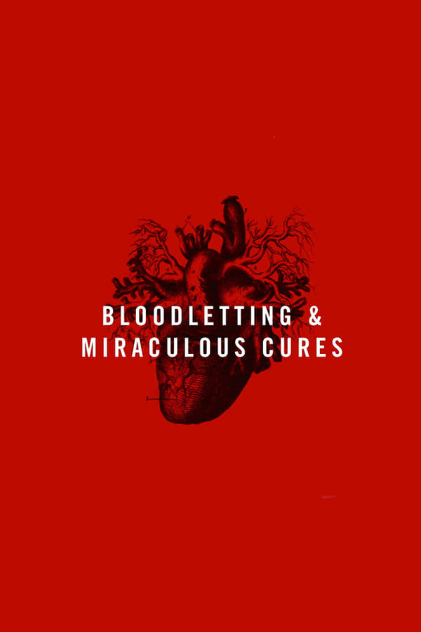 Bloodletting & Miraculous Cures