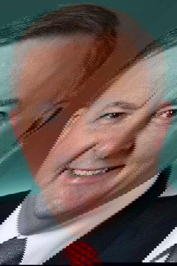 Anthony Albanese
