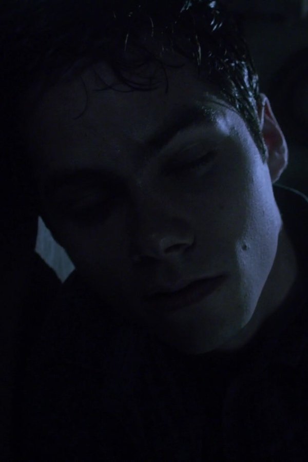 Teen Wolf – S03E19 – Letharia Vulpina