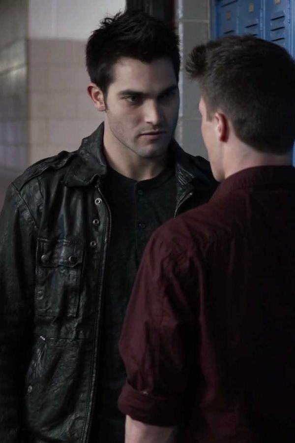 Teen Wolf – S01E04 – La stagione della caccia