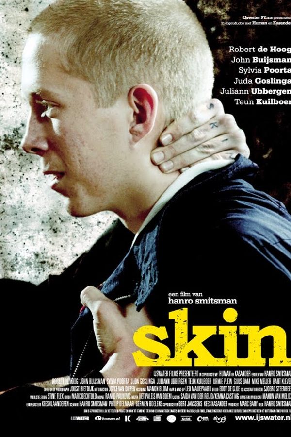 Skin – Hass war sein Ausweg