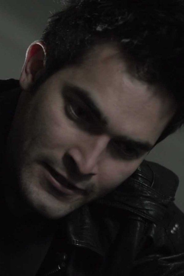 Teen Wolf – S01E06 – Battito animale