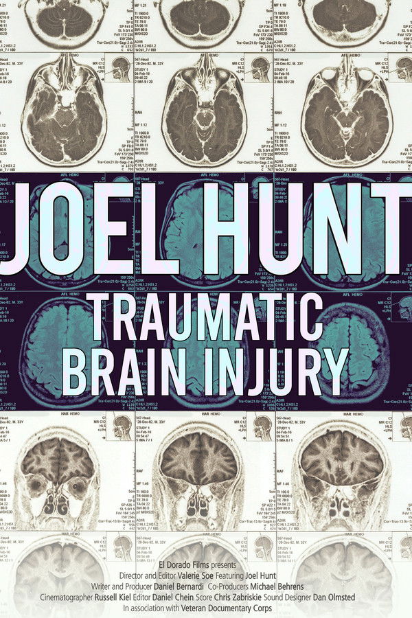 Joel Hunt: Traumatic Brain Injury (TBI)