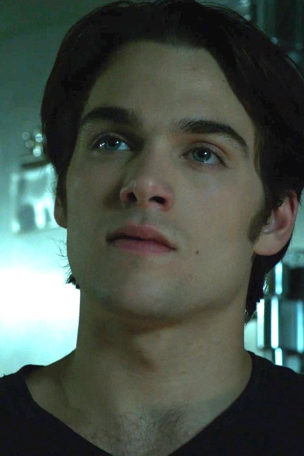 Teen Wolf – S06E09 – Episodio 9