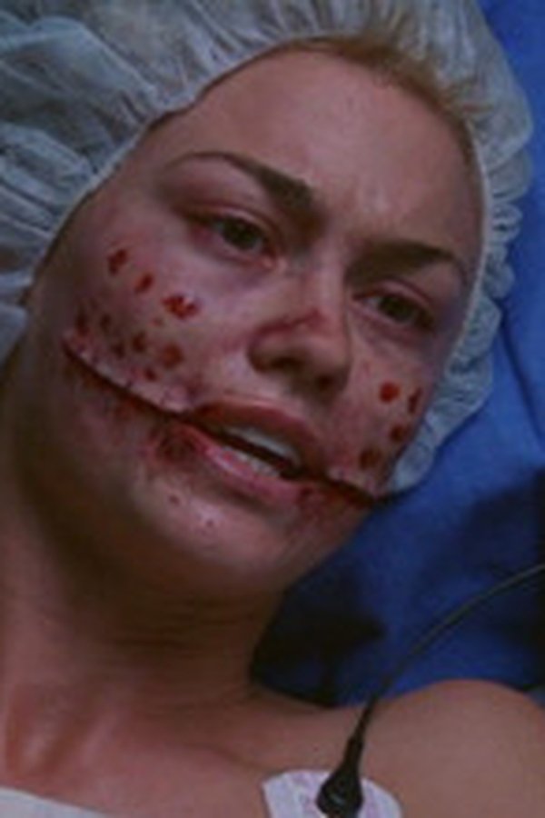 Nip/Tuck – S03E14 – Cherry Peck