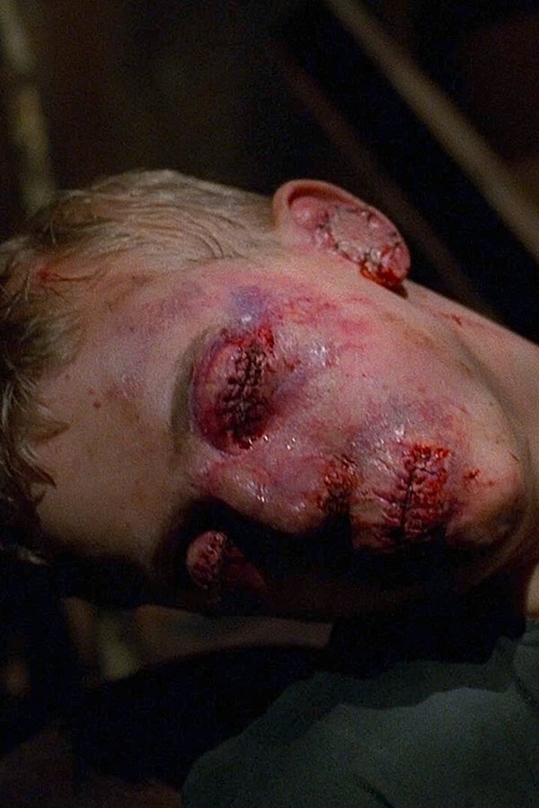 X-Files – S05E13 – La paziente X