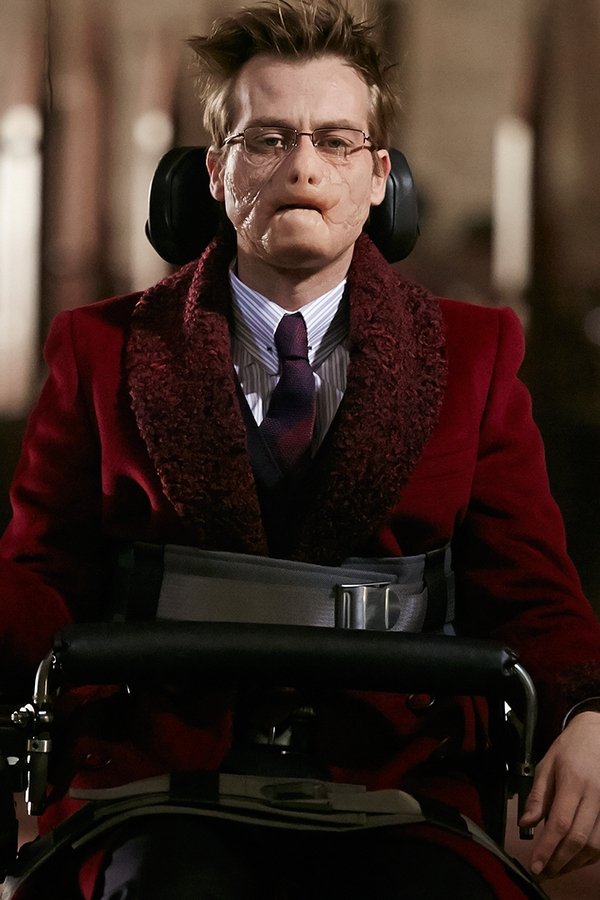 Hannibal – S03E07 – Digestivo