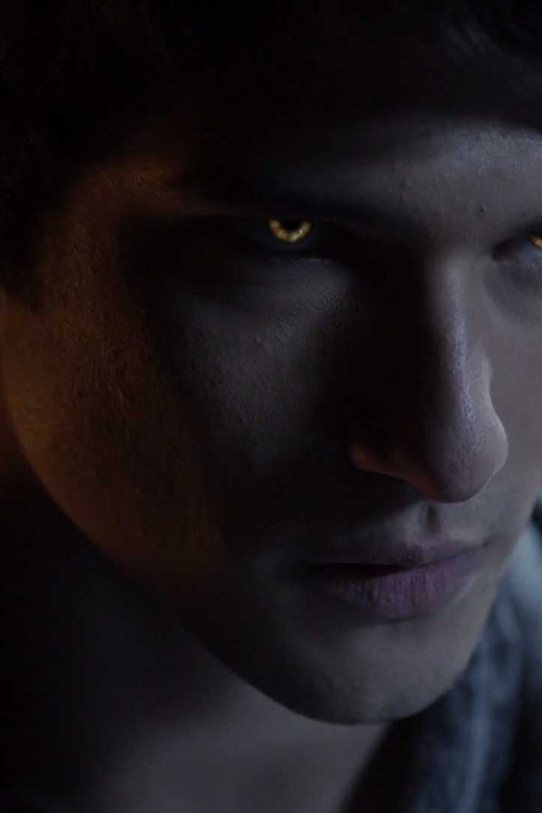 Teen Wolf – S01E08 – Lunatico