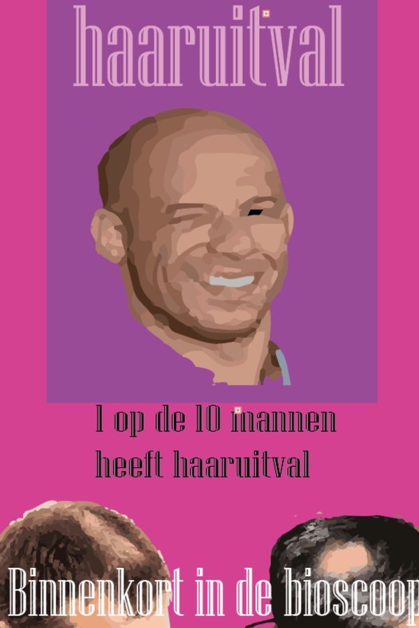 Kaal worden. Wat kan ik doen? poster
