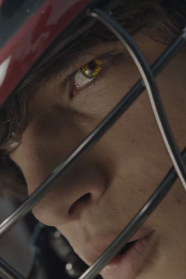 Teen Wolf – S01E02 – La partita più importante