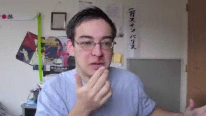 Epic Nosebleed