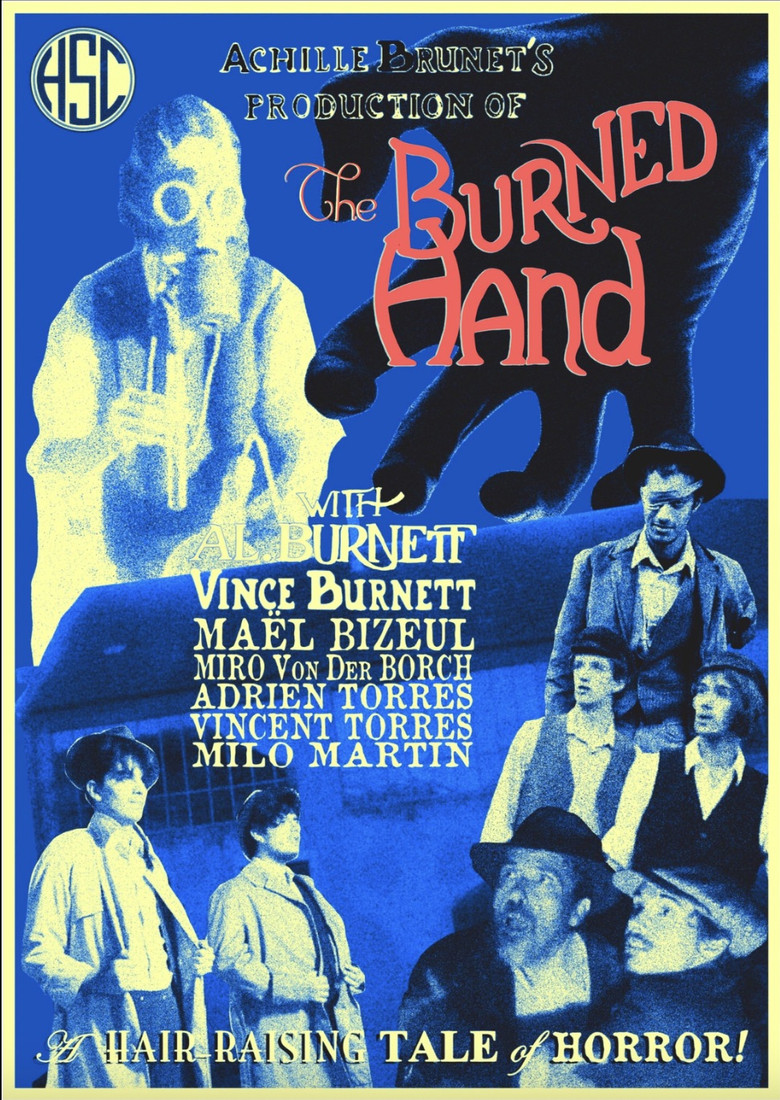 The Burned Hand