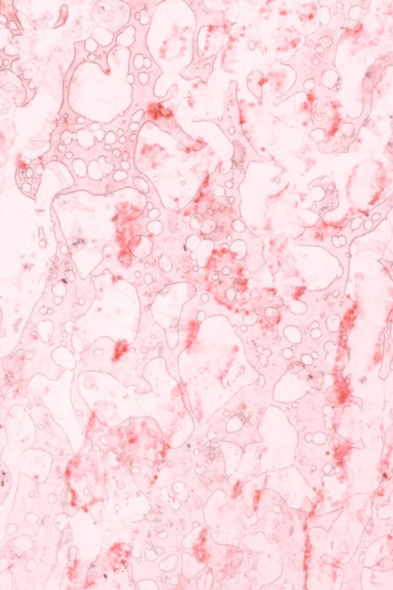 Earthworms Spit Love Songs