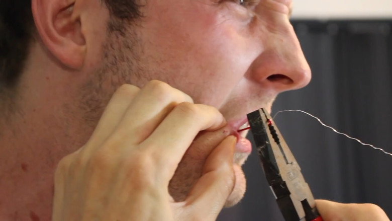 fish hook through the cheek