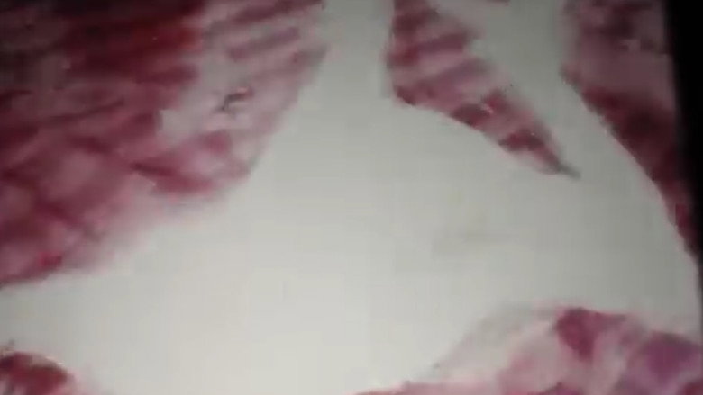 removed backdrop 3