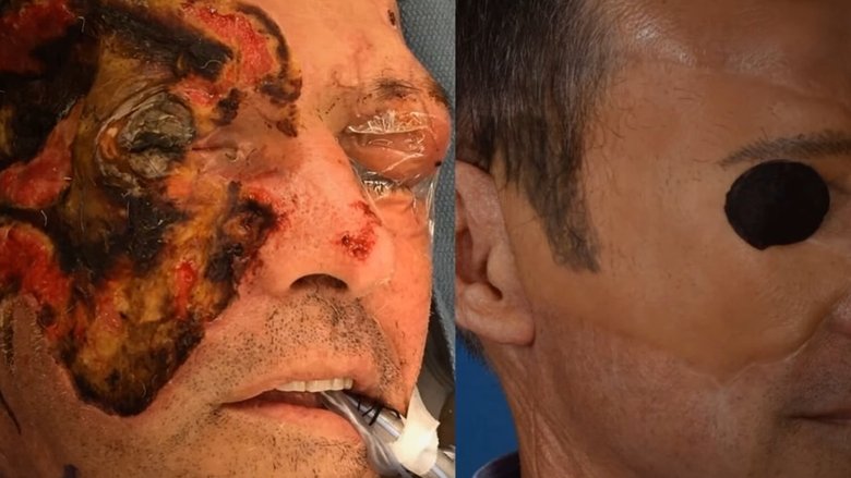 Mystery of the Eyelid