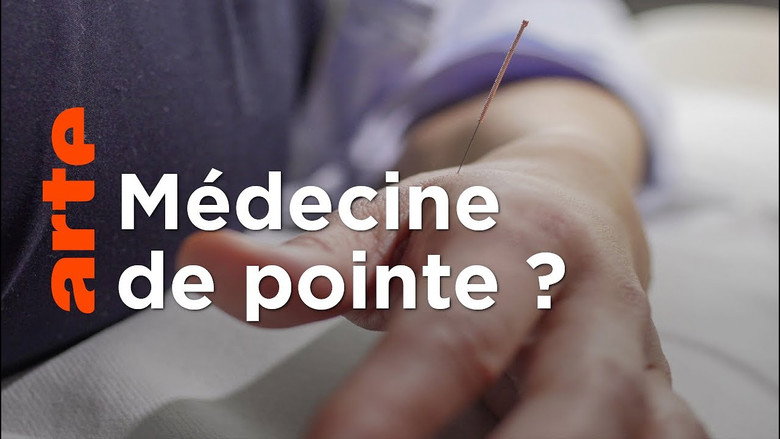 Spitzenmedizin: Akupunktur - Mythos oder Therapie? backdrop 2