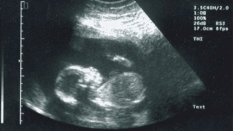 50 Fetus - In Da Whomb