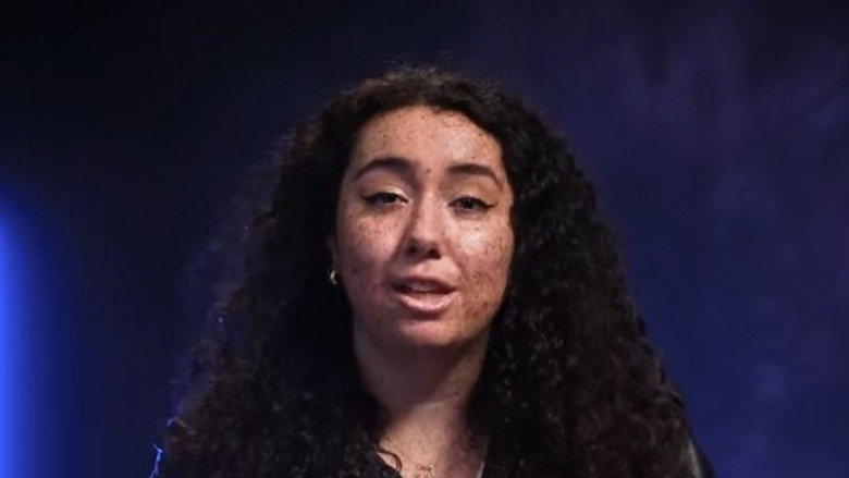 CHILD OF THE MOON: EXPOSURE TO THE SUN COULD KILL HER