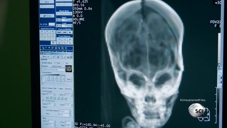 Peruvian Alien Skull & Baltic Sea UFO