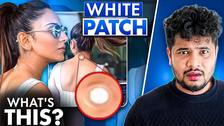 What Media Didn’t Tell You About Rakul Preet’s Wellness Patch.