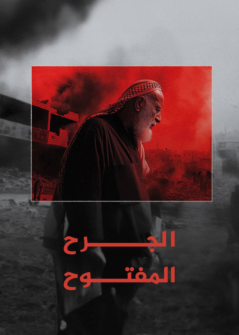 ‏الجرح المفتوح