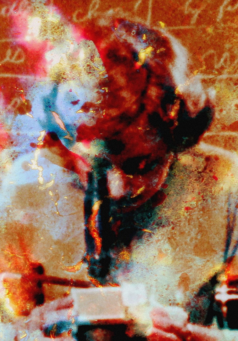 Imatge de Pigment-Dispersion Syndrome