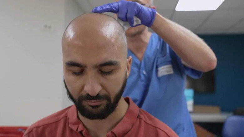 Imatge de Migraine : la fin du casse-tête ?