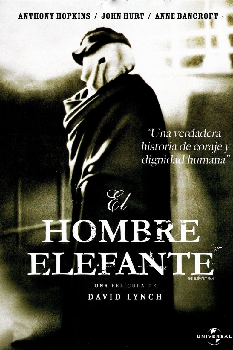 El hombre elefante (1980)