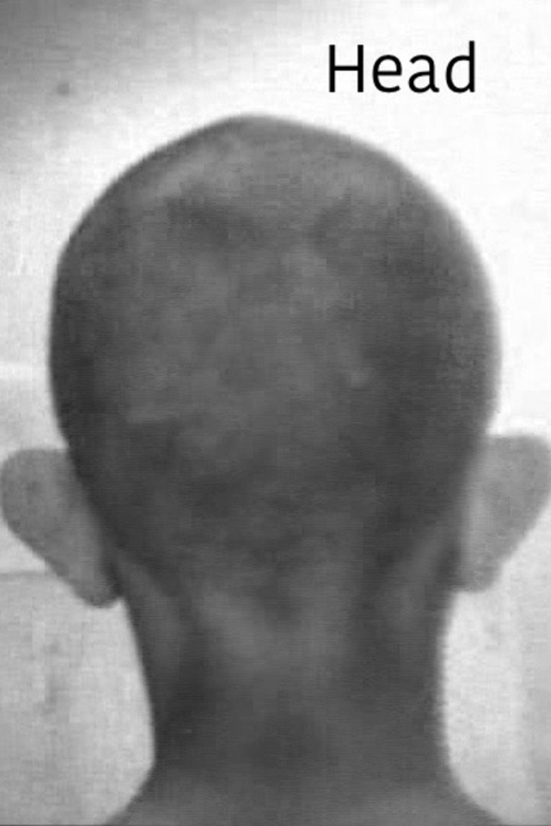 Head