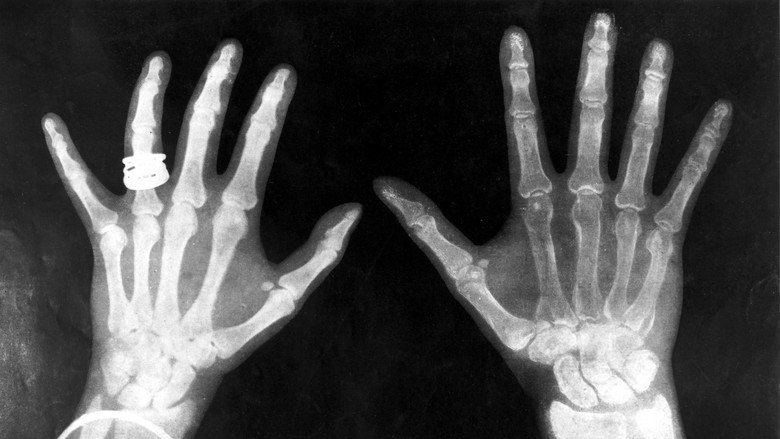 Hair Raising Science episode still