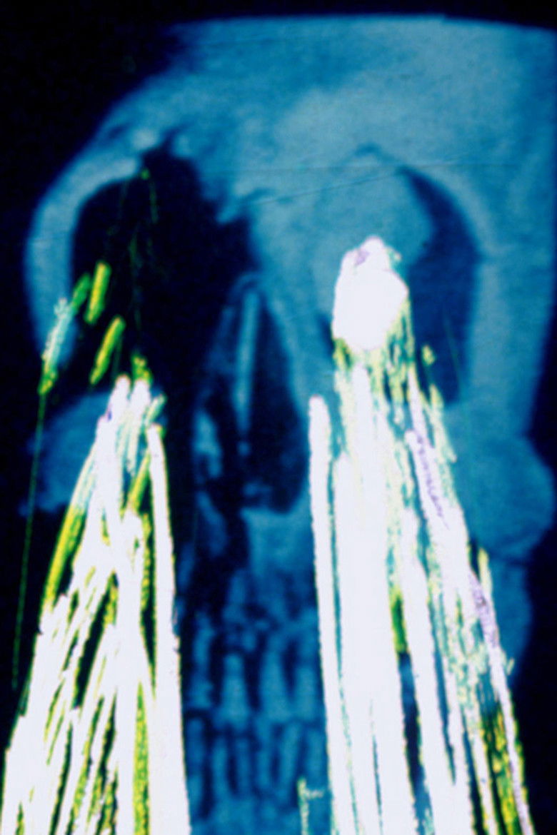 Imatge de O Colírio do Corman Me Deixou Doido Demais