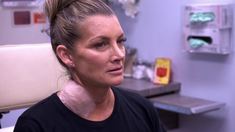Still image for Dr. Pimple Popper season 1 episode 2: The World's Largest Lump