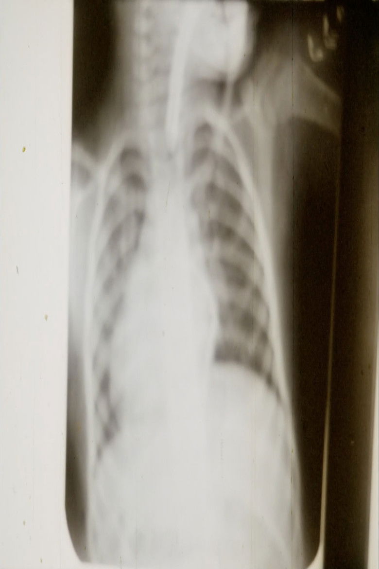 Imatge de Cirurgia do Coração no Espírito Santo