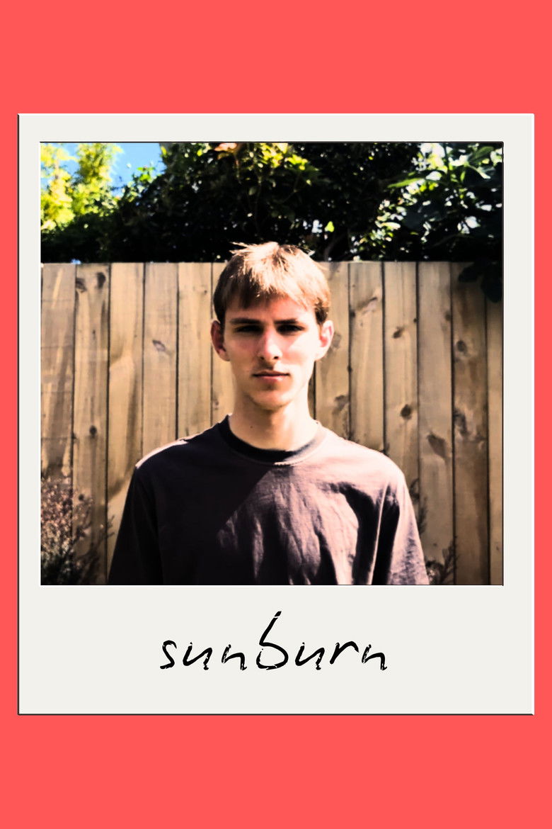 Imatge de Sunburn